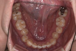 治療前（写真3）