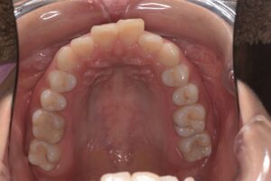 治療前（写真3）