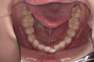 治療前（写真3）