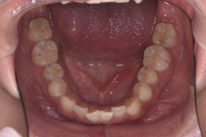 治療前（写真3）