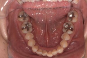 治療前（写真3）