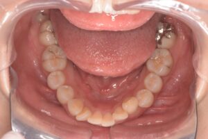 治療前（写真3）