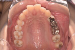 治療前（写真2）