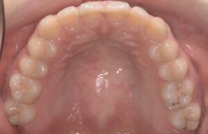 治療前（写真2）