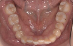 治療前（写真3）