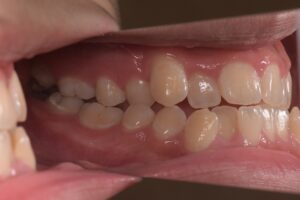 治療前（写真3）