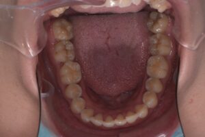 治療前（写真3）