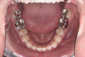 治療前（写真3）