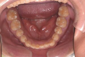 治療前（写真3）