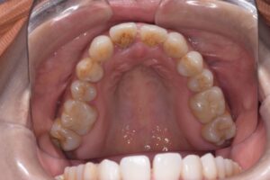 治療前（写真2）