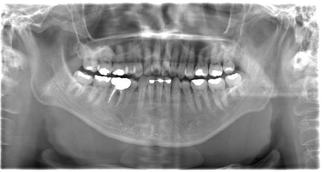 治療前（写真2）