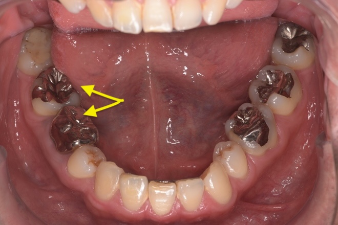 治療前（写真1）