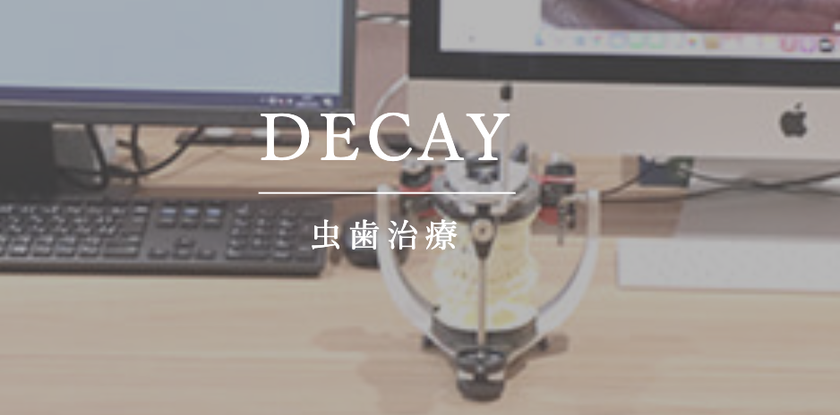 赤坂さくら歯科クリニックの虫歯治療