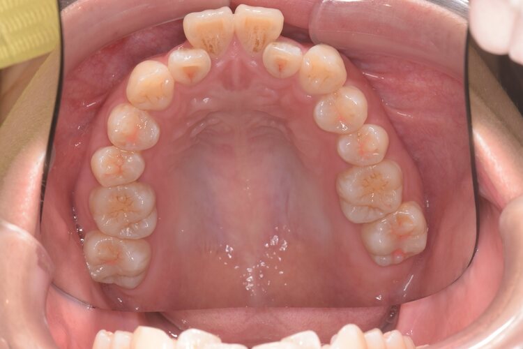 治療前（写真3）