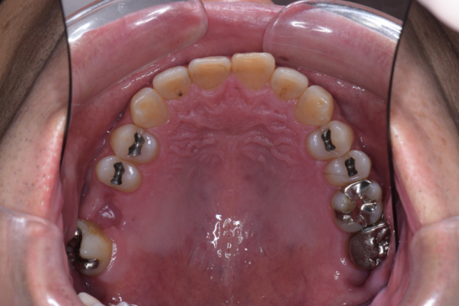 治療前（写真1）