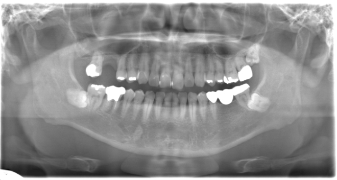治療前（写真3）