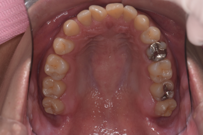 治療前（写真2）