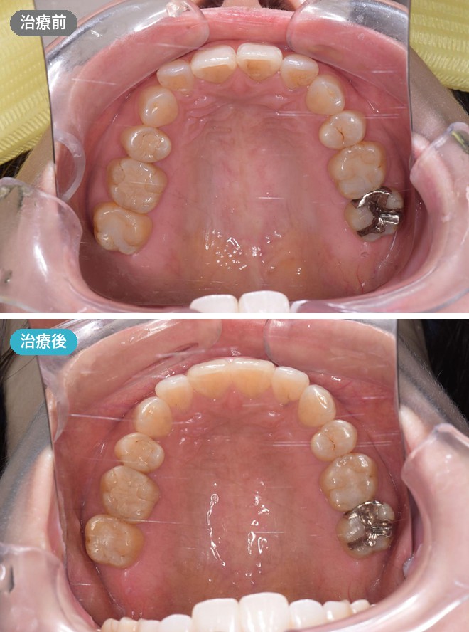 症例写真 治療前と治療後
