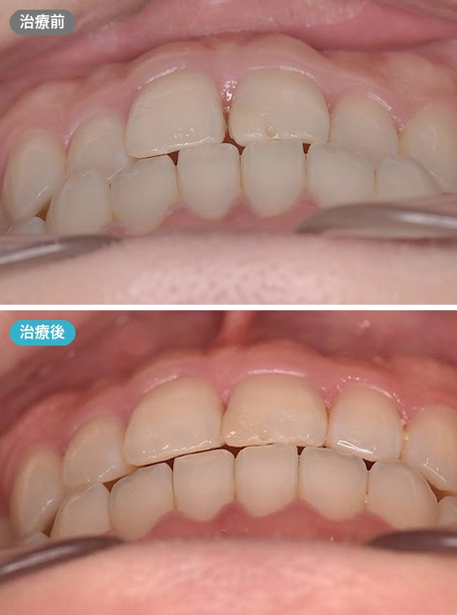 症例写真 治療前と治療後