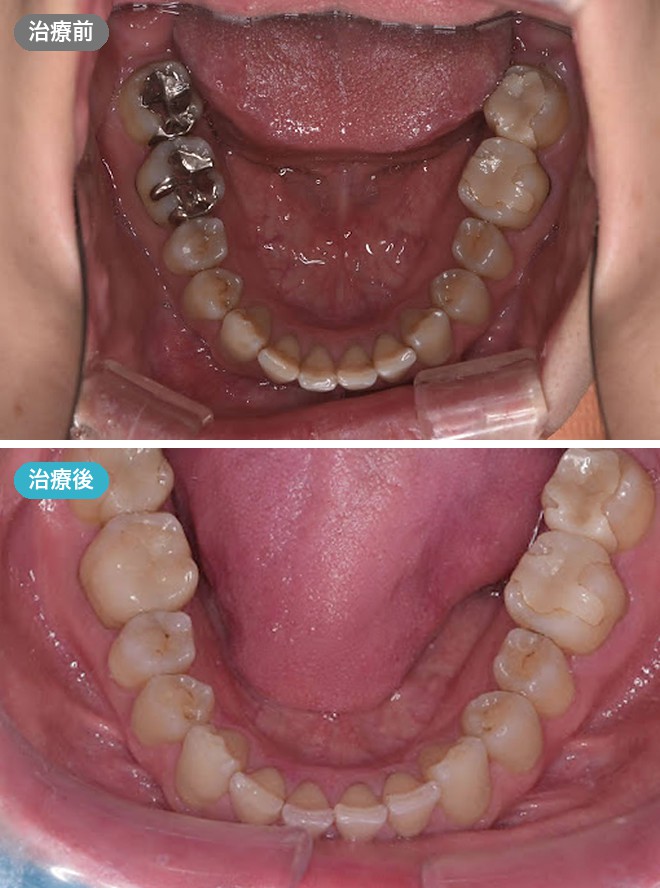 症例写真 治療前と治療後