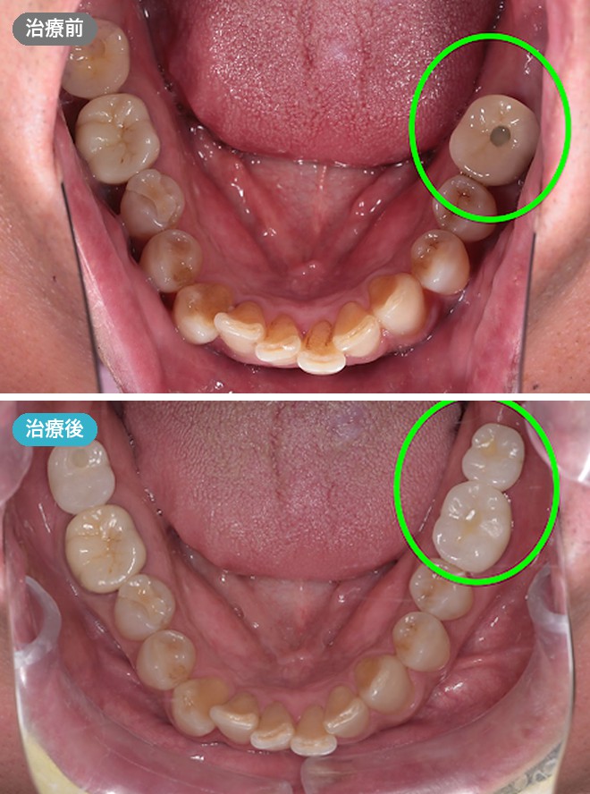 症例写真 治療前と治療後